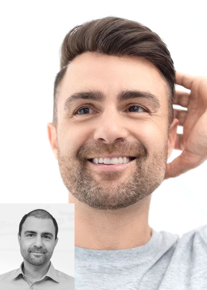 Perma Space PermaFit Synthetic Pro-Tec Fiber Permanent Whole Lace Wig for Men Ellen Wille UK - with before photo